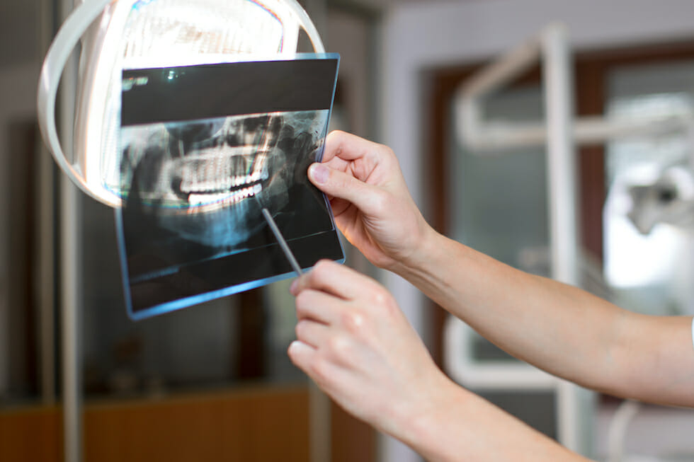 reviewing dental xray under a light