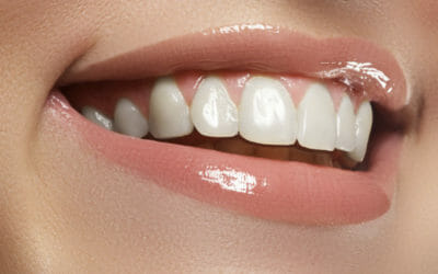 Orthodontic Treatment Has The Following Benefits:
